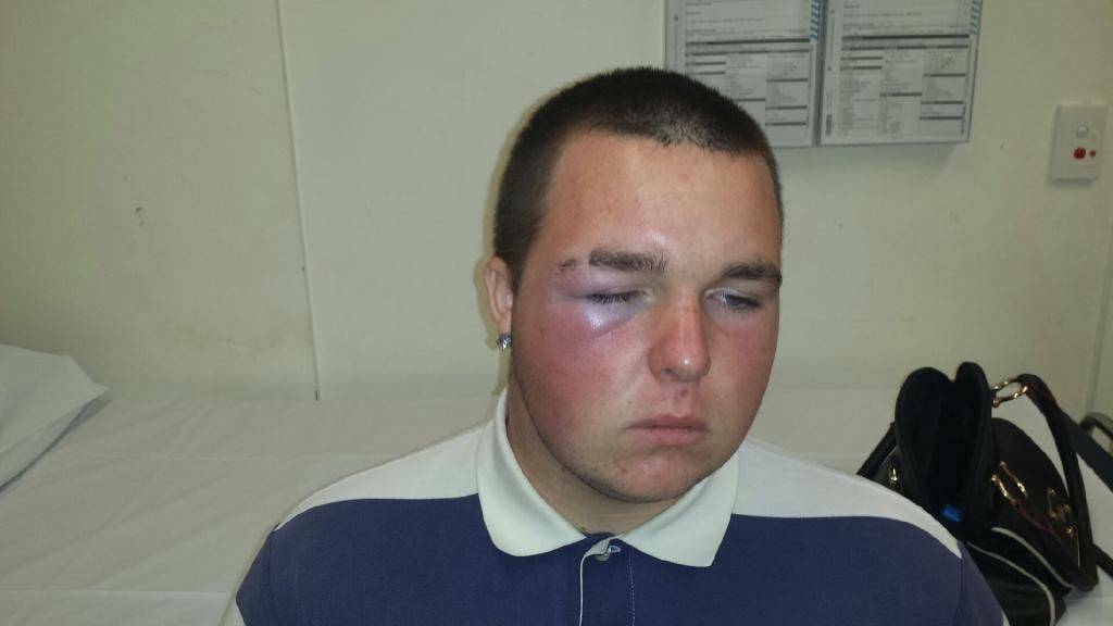 Thornlands teen Billy Bryce was attacked in Crystal Waters Park on Sunday. Pic: Bayside Bulletin