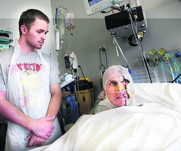 FATHER AND SON: Cameron and Bernie Schulte in the burns unit at Sydney’s Concord Hospital this week.