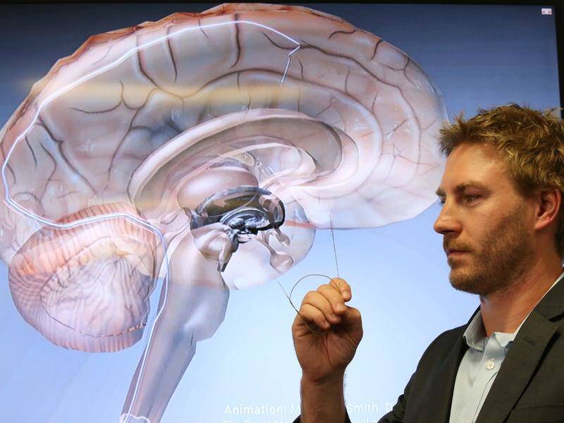 Researchers have developed a tiny device to stimulate the brain in the hope of treating epilepsy.